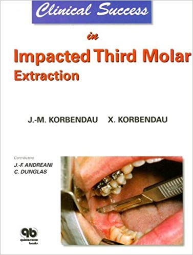 Clinical Success In Impacted Third Molar Extraction